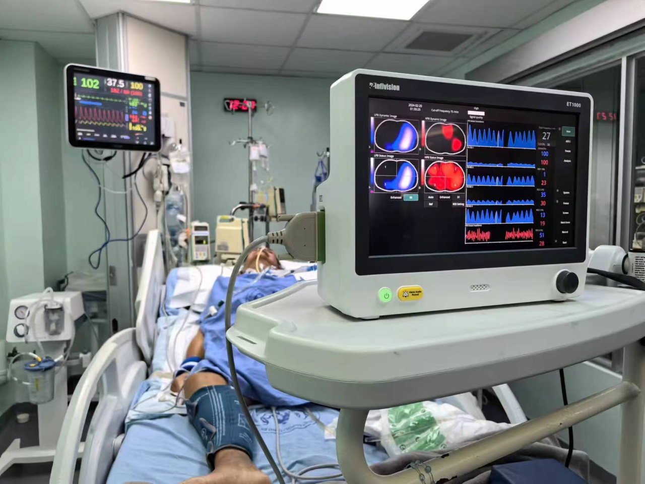 AI Empowering Medical Imaging: Bringing Quality Healthcare Resources Within Reach